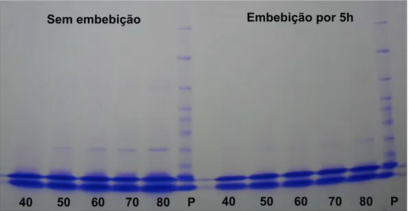 Figura 6 – Perfil eletroforético de proteínas resistentes ao calor em sementes  de pimenta ornamental, submetidas ou não à embebição aos 40,  50, 60, 70 e 80 dias após abertura floral