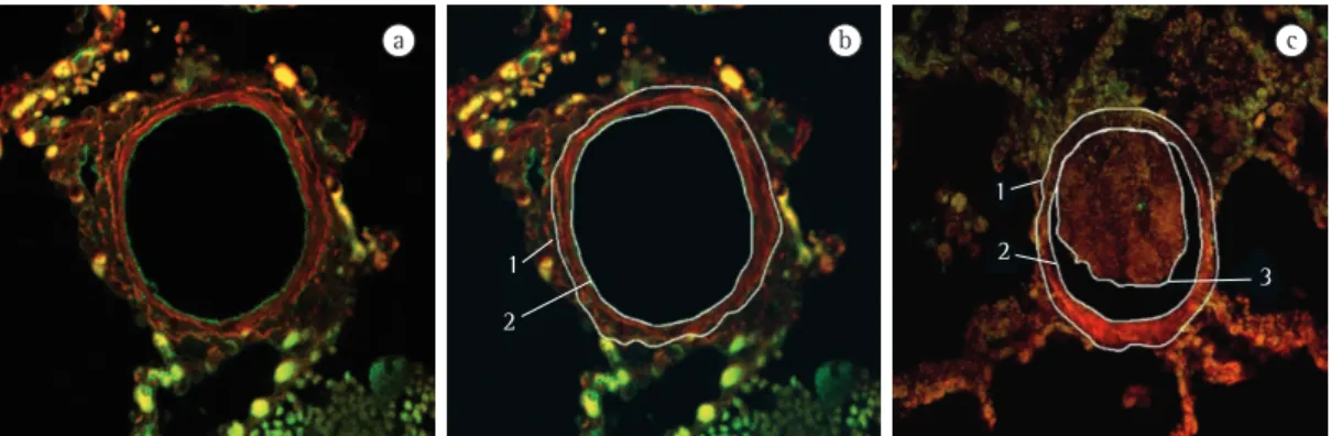 Figure 1 - Confocal laser scanning microscopy images. In a), a normal pulmonary artery with the endothelium  marked  in  green  (control  group)