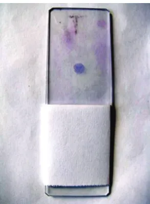 Figure  1  -  Slide  with  BAL  fluid  sample  after  cytocentrifugation  (macroscopic  aspect)