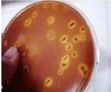 Figura 8 – Colônias de espécies de bactérias do ácido lático, isoladas, da fermentação  natural  de  polvilho,  em  ágar  APT  modificado  (halo  amarelo  ao  redor  das  colônias, típico de crescimento de BAL)