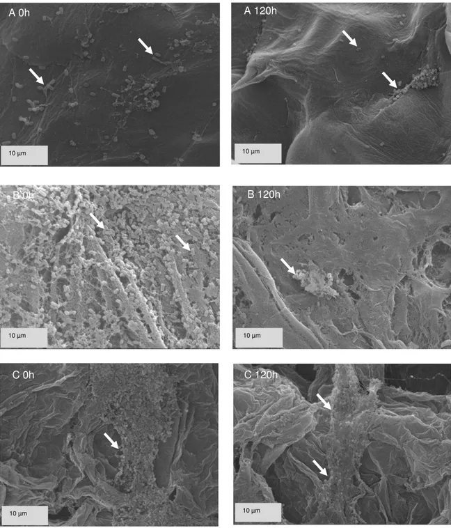 Figura 8  – L. acidophilus aderidos à superfície das frutas maçã (A), mamão  (B) e manga (C) logo após o processamento das saladas (tempo 0) e após  120 horas de armazenamento