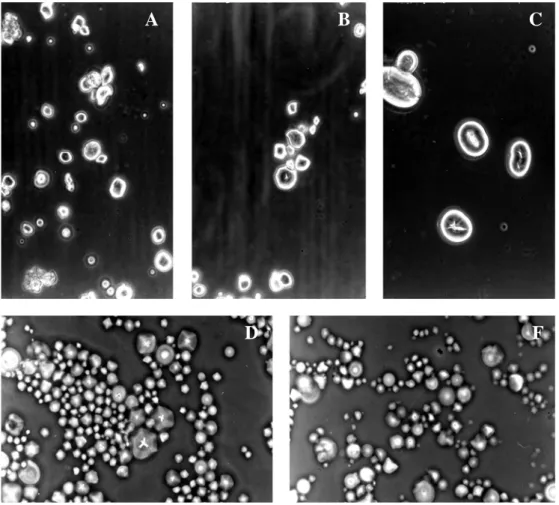 Figura 7 - Fotomicrografias dos grânulos de amido dos frutos da lobeira claro (a),  escuro (b), feijão (c), batata-inglesa (d) e mandioca (e)