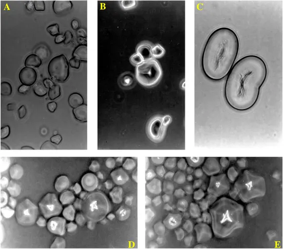 Figura 8 - Fotomicrografias dos grânulos de amido dos frutos da lobeira claro (a),  escuro (b), feijão (c), batata-inglesa (d) e mandioca (e)