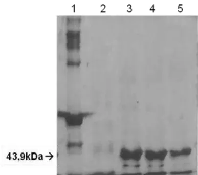 Figura 8- Analise do grau de pureza da rNTPDase2 por eletroforese  capilar. O padrão do grau de  pureza  da    rNTPDase2  foi  analizado  usando  amostra  na  concentração  de    51,3  ng/µL  em  LabChip ®  Agilent Protein 230 Kit (Agilent 2100 Bioanalyzer