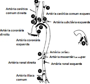 Figura  1 –  Sítios  de  predileção  para  desenvolvimento  das  lesões  ateroscleróticas  em  camundongos  ApoE -/-   destacados  em  preto