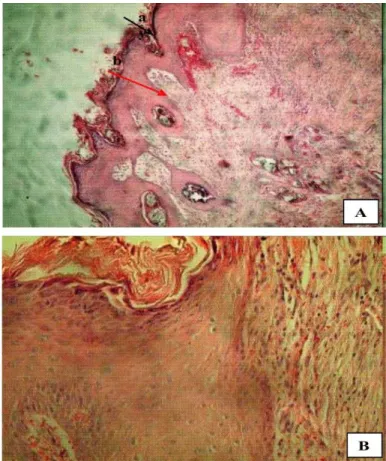 Figura 4 – Fotomicrografia de epiderme de coelhos do grupo normal (G1). (A) aumento  10X; e (B) aumento de 40X