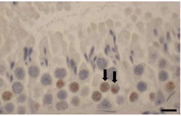 Figura 4.  Espermatócitos primários em  zigóteno marcados  (setas) no estádio  3 do CES,  72 h após injeção de 5-bromodeoxiuridina no testículo de Oxymycterus rufus