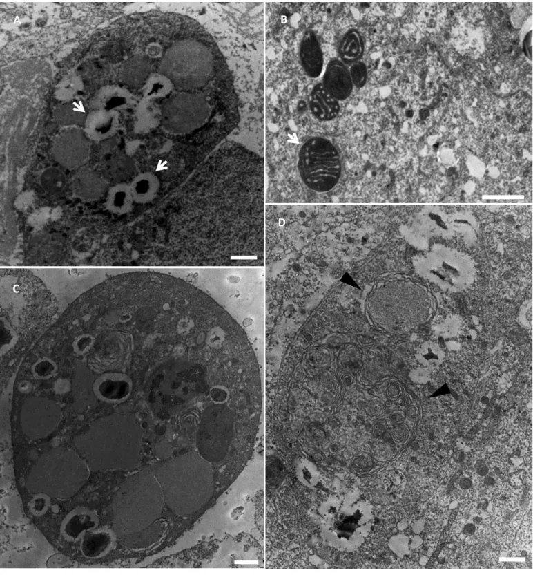 Figura 6: Morte celular no intestino médio de M. quadrifasciata anthidioides.  A. Em pré-pupa nota-se  fragmentação nuclear (seta) de uma célula apoptótica
