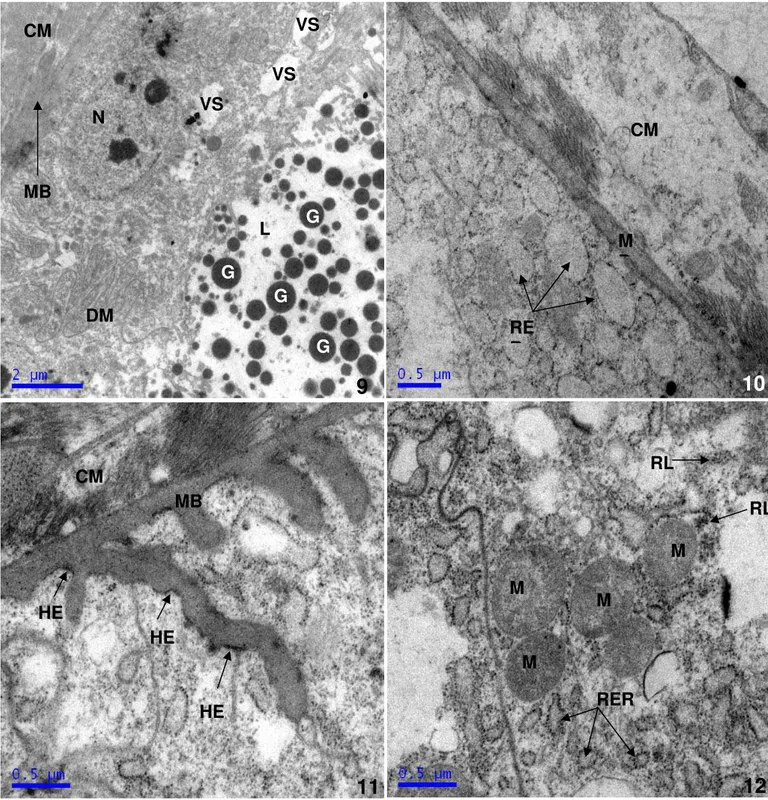 Fig. 9 e 10: Micrografia da porção basal do epitélio glandular de  Mischocyttarus.  (9) Núcleos de células epiteliais 