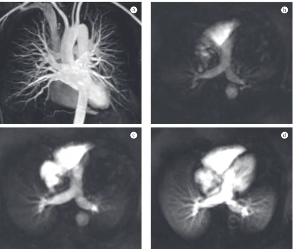 Figure 6 - Magnetic resonance angiography (MRA) images of the chest of a healthy individual
