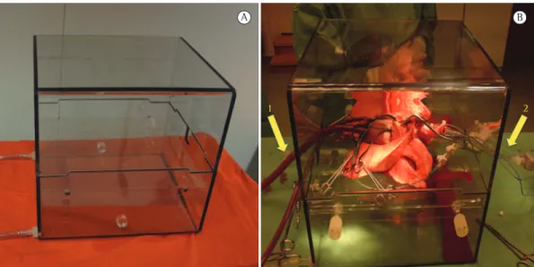 Figure 1 - Ex vivo lung perfusion model used by the lung transplant group at Lund University, Lund,  Sweden