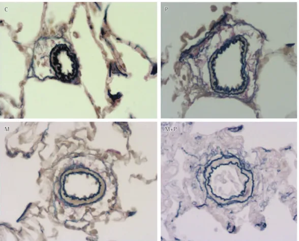 Figure 3 - Sample images of histological sections of the media of acinar arterioles (magnification, ×400)