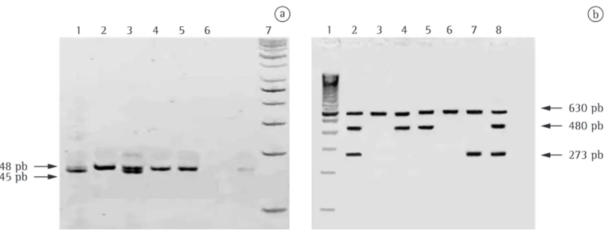 Figure 1 - Polymerase chain reaction for the detection of the ∆F508 mutation in the cystic fibrosis transmembrane  conductance regulator ( CFTR ) gene, as well as of the deletion of glutathione S-transferase (GST) genes  mu-1 ( GSTM1 ) and  theta-1  ( GSTT