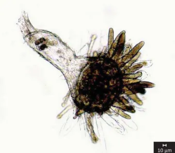 Figura 2. Blastocladia pringsheimii. Detalhe do esporo de resistência. Figure 2. Blastocladia pringsheimii