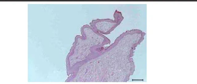 Figura 7. Fotomicrografia da porção distal da papila mamária. Notar a ausência do músculo esfíncter papilar
