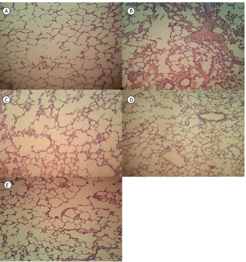 Figure 5. Lung tissue samples stained with hematoxylin and eosin (original magniication, ×100): (A) control group  sample, showing no remarkable pathological changes; (B) ischemia/reperfusion (I/R) group sample, showing widespread  histological changes suc