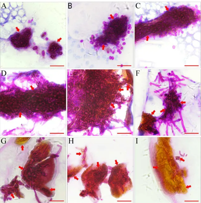 Figure  4  Histopathological  identification  of  melanized  encapsulations.  A  3  h  post-infection  (PI),  melanized  encapsulations encysted yeast from fungal cells