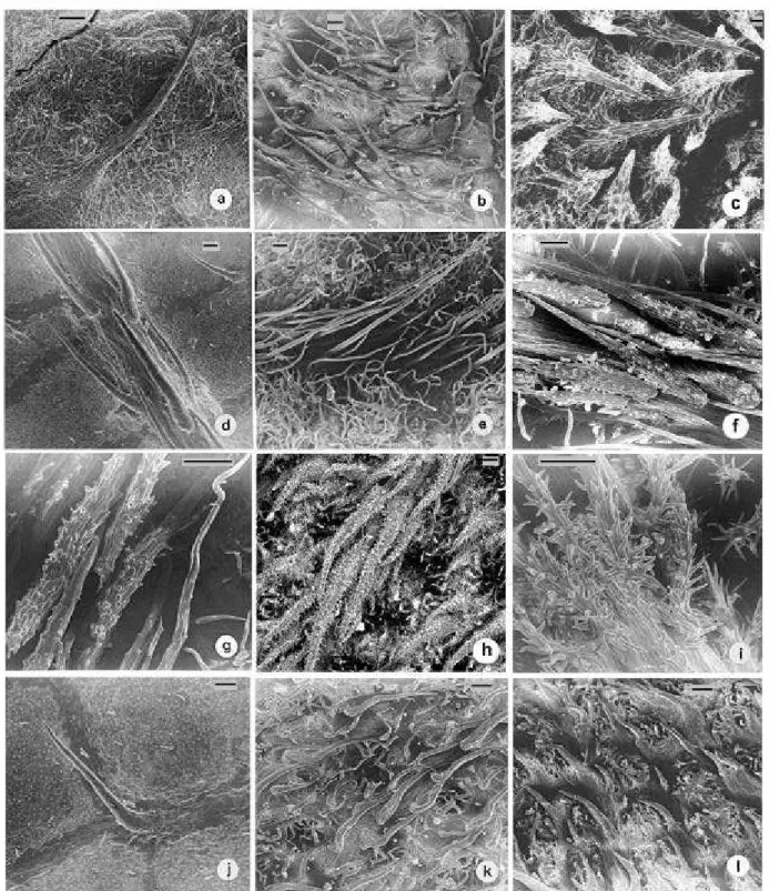 Figura 2. Eletromicrografias de varredura dos tricomas foliares, da face superior: a) Tibouchina virgata X 75; b) T.