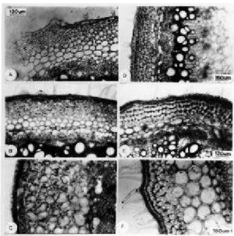 Figura 5 . Seção transversal da região mediana do entrenó do caule de plantas de Lycopersicon   Mill