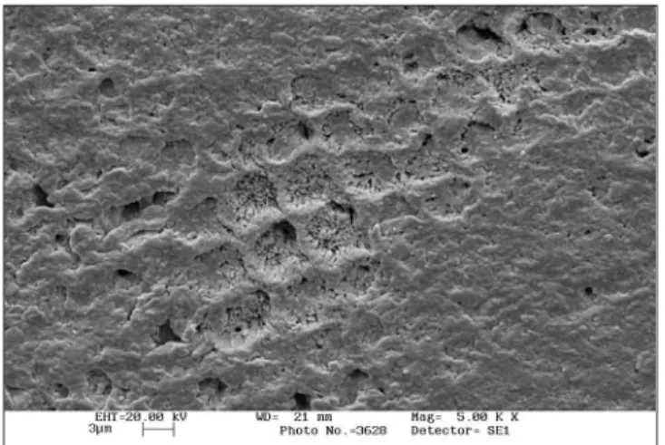 FIGURE 7 -   Enamel  surface  exposed  to  Whiteness  HP  (35%  hydrogen  peroxide).  Erosion  or  intraprismatic  structure dissolution can be noted (5,000 X).