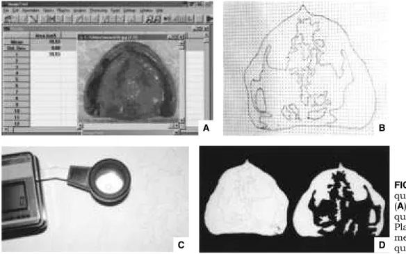 FIGURE 1 -  ImageTool  quantification method  ( A ). Point-counting  quantification method ( B )