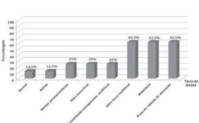 Fig. 2 - Porcentagem dos achados tomográficos nos pacientes tratados cirurgicamente para oclusão do canal arterial (grupo B)