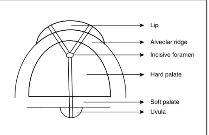 Table 1 reveals the overall distribution of the  several types of clefts.