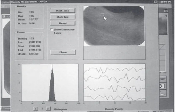 FIGURE  2  -   The  Digora    program  screen,  presenting  the  functions  necessary  for  the  mensuration  of  gray  levels.