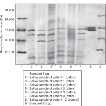 Figure 1  illustrates  an  example  of  electro- electro-phoretic records which show alterations in RM  between bands of molecular weights 72,000 to  55,000 Daltons between groups I and II.