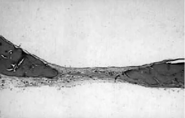 FIGURE 1 - In control groups, osteoblasts surfacing the  bone  were  cubical  or  cylindrical