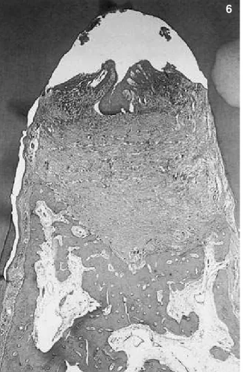 FIGURE 6 -  Test Group 2 – panoramic view of the lesion  demonstrating considerable extension of new cementum