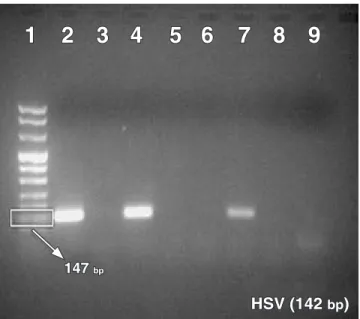 FIGURE 3 -  Amplicons of nested PCR for HSV (Herpes  Simplex  Virus).  Column 1:  molecular  weight  marker  VIII