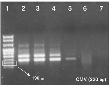 TABLE 3 -  Results of the Sensitivity test for CMV, EBV  and HSV. Virus   type Sensitivity Test Brazil USA CMV 0,5 pg 0,5 pg EBV 50 ng 50 ng HSV 5 × 10 -5  pg 5 × 10 -5  pg CMV: Cytomegalovirus; EBV: Epstein-Barr Virus; HSV: Herpes  Simplex Virus.