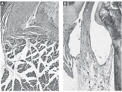 FIGURE 2 -  Formalin group.  A:  mild  neutrophilic exudation extending  along muscular ﬁbers three hours  later;  B:  seroﬁbrinous-hemorrhagic  exudate, congested blood vessels and  cellular inﬁltration in the condylar  neck region three days later