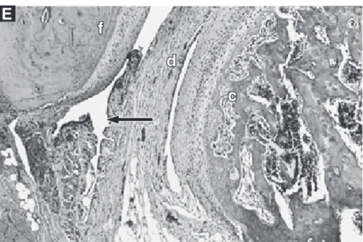 FIGURE 2 (continued) - Formalin group. C: hyperplasia  of the synovial lining with villous changes (arrow)  seven days later; D: hyalinization and thickening of the  condylar articular surface (arrow), inﬂammatory reaction  in the articular capsule, with s
