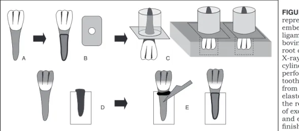FIGURE 1 -  Schematic  representation of root  embedment and periodontal  ligament simulation: (A)  bovine incisor tooth; (B) tooth  root covered with wax and  X-ray ﬁ lm; (C) ﬁ lm and plastic  cylinder positioned over a  perforated wood plate; (D)  tooth 