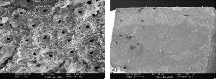 FIGURE 3b -  SEM micrographs of the enamel side of fractured specimens that had been restored with Clearﬁl SE  Bond