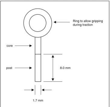FIGURE 1 - Schematic drawing of the post-core conigu- conigu-ration.