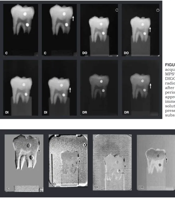 Figure  2  shows  logarithmically  contrast-en- contrast-en-hanced  subtraction  images  produced  with  the 