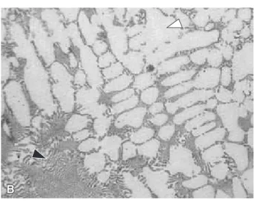 FIGURE 3 - Optical micrographs of as-received alloys,  with the typical dendritic solidiication microstructure