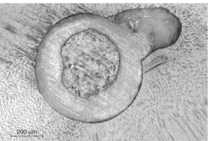 FIGURE 2 - Cross section of the root canal space con-