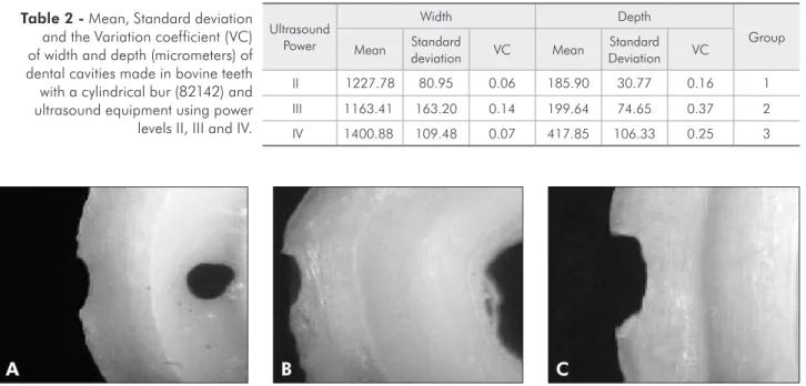 Table 2 - Mean, Standard deviation  and the Variation coefficient (VC)  of width and depth (micrometers) of  dental cavities made in bovine teeth  with a cylindrical bur (82142) and  ultrasound equipment using power  levels II, III and IV.