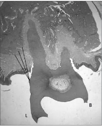 Figure  2  -  Morphometric  analysis:  linear  measurement  from bone crest to cementoenamel junction.