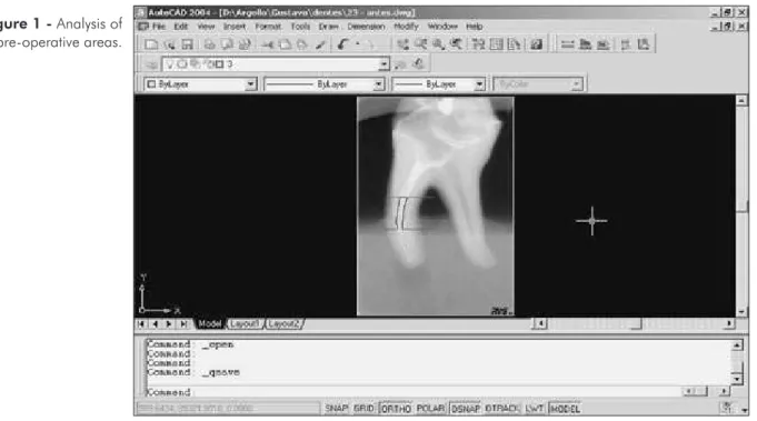 Figure 1 - Analysis of   pre-operative areas.