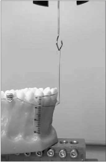 Figure  1  -  Phantom  upper  jaw  with  gum  area  enlarged,  allowing  fixing  of  three  rulers,  facilitating  bilateral  control  during arch execution.