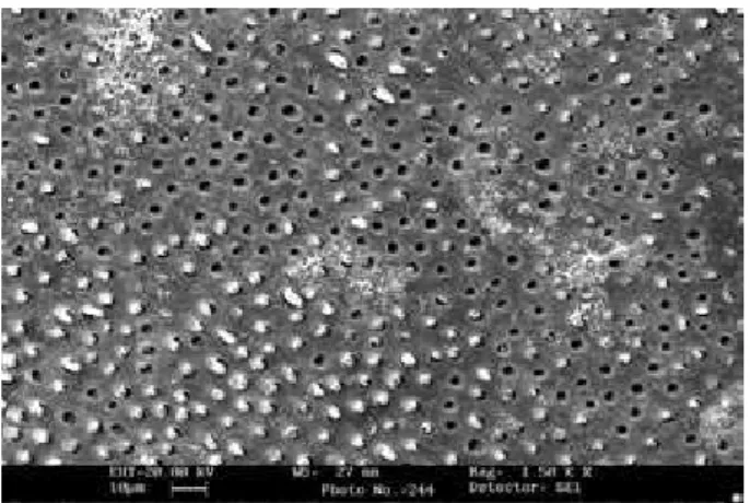 Figure 2 - SEM showing a mixed failure in the 0.2% thymol  group  tested  after  15  days,  with  maintenance  of  the  resin  cement over half of the specimen and removal of the resin  cement and permanence of the hybrid layer over the other  half of the 
