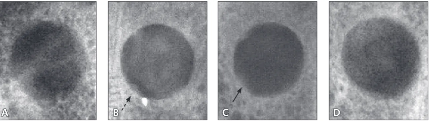 Figure 1 - Digital radiographic images of bone defect in the parietal bone of rabbit taken at 15 days: (A) control group; (B)  diabetic group presenting radiopaque areas next to the defect walls (dotted arrow); (C) diabetic-PTFe group presenting extensive,