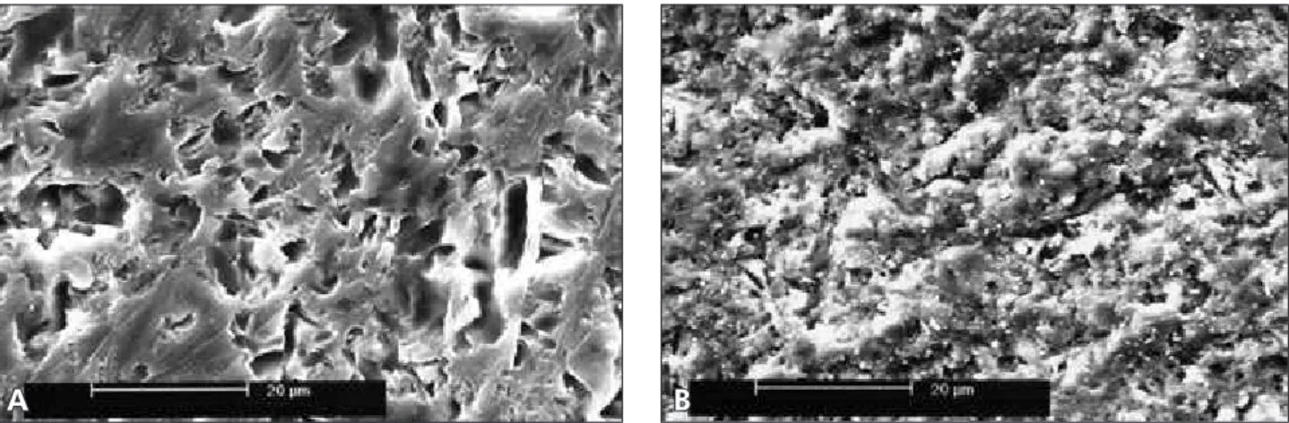 Figure 2 - V ceramic surface etched with HF acid only pre- pre-sented  a  highly  porous  surface  pattern  with   three-dimen-sional lattice of voids and channels (original magnification  1,500 X).