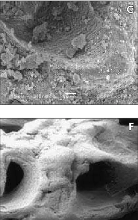 Figure 1 - Electronmicrographs of  the studied Biomaterials. Bio-Oss  (A-D). Particles with regular dimensions  covered with nanoparticles, and showing  different pore sizes (arrows)