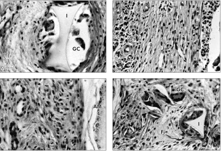 Figure 1 - Microscopic features (40 X) after 21 days. A (Group A) – multinuclear giant cells (GC), foreign body granulomas  near the implant (I)